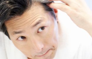 بهترین راه برای درمان شوره سر در خانه