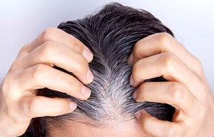 راهکار جلوگیری از خاکستری شدن موها