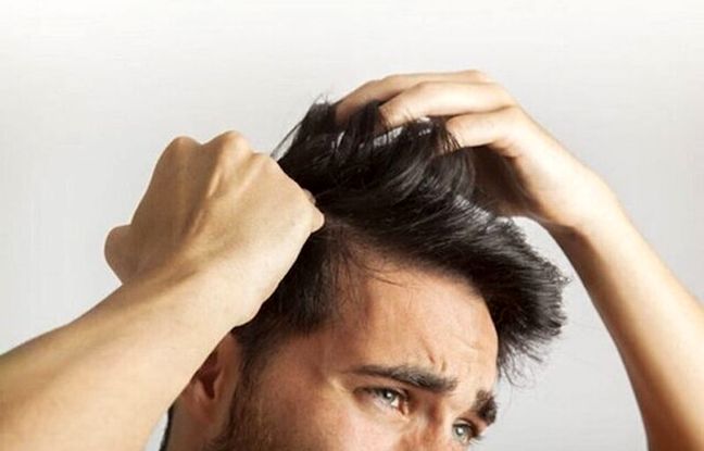 خارش سر ناشی از کمبود چه ویتامینی است؟