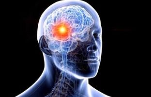 علائم هشدار دهنده تومور مغزی