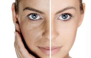 چهار مرحله برای مراقبت از پوست 