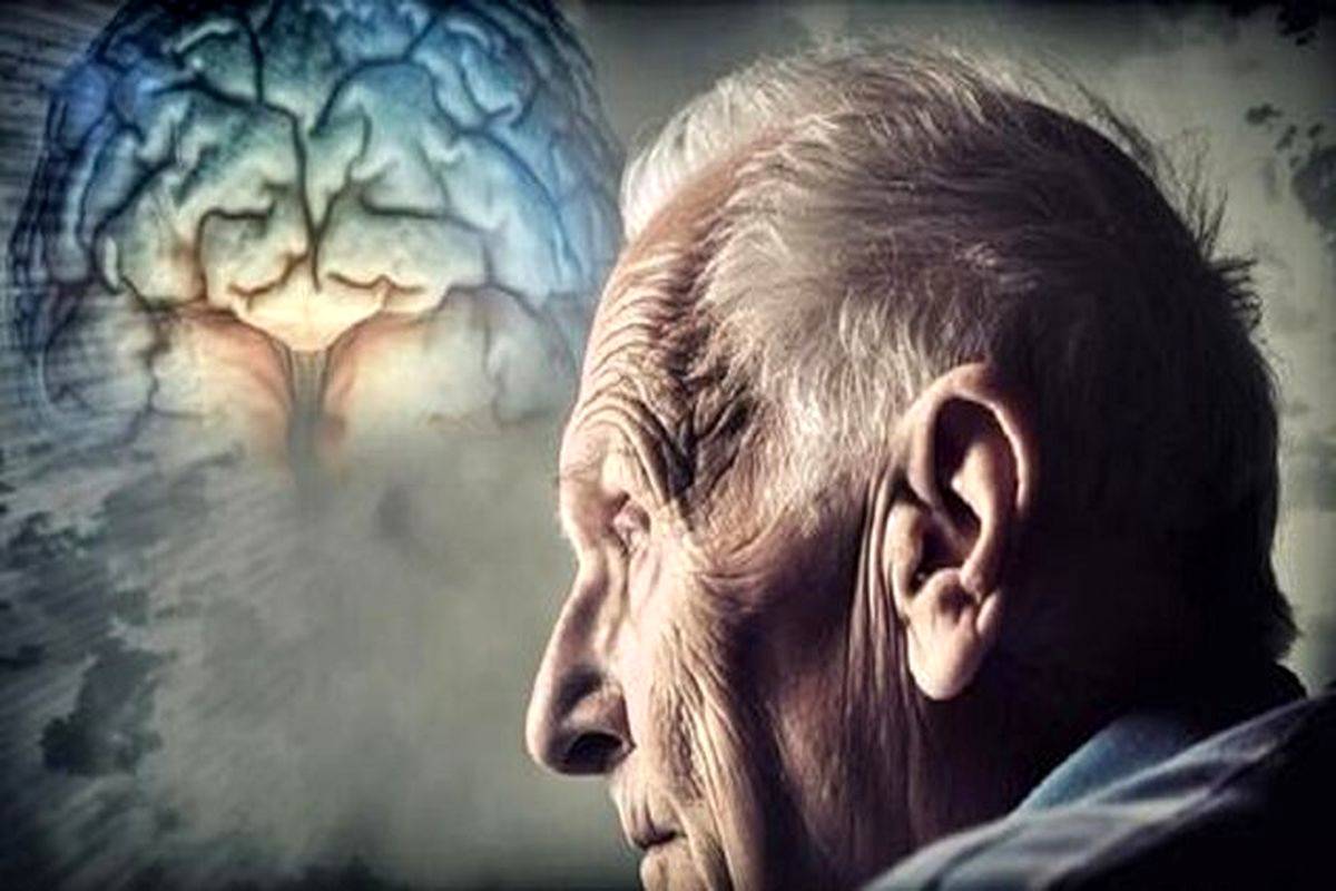 هوش مصنوعی یک علت جدید را برای آلزایمر کشف کرد