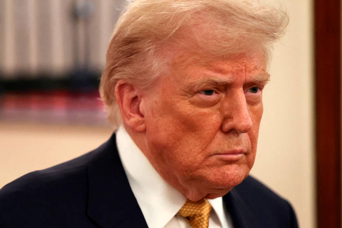 کاخ سفید از ابتلای ترامپ به نارسایی مزمن وریدی خبر داد