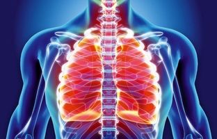 افراد در رویارویی با ویروس‌های تنفسی، درگیر برونشیت حاد می‌شوند