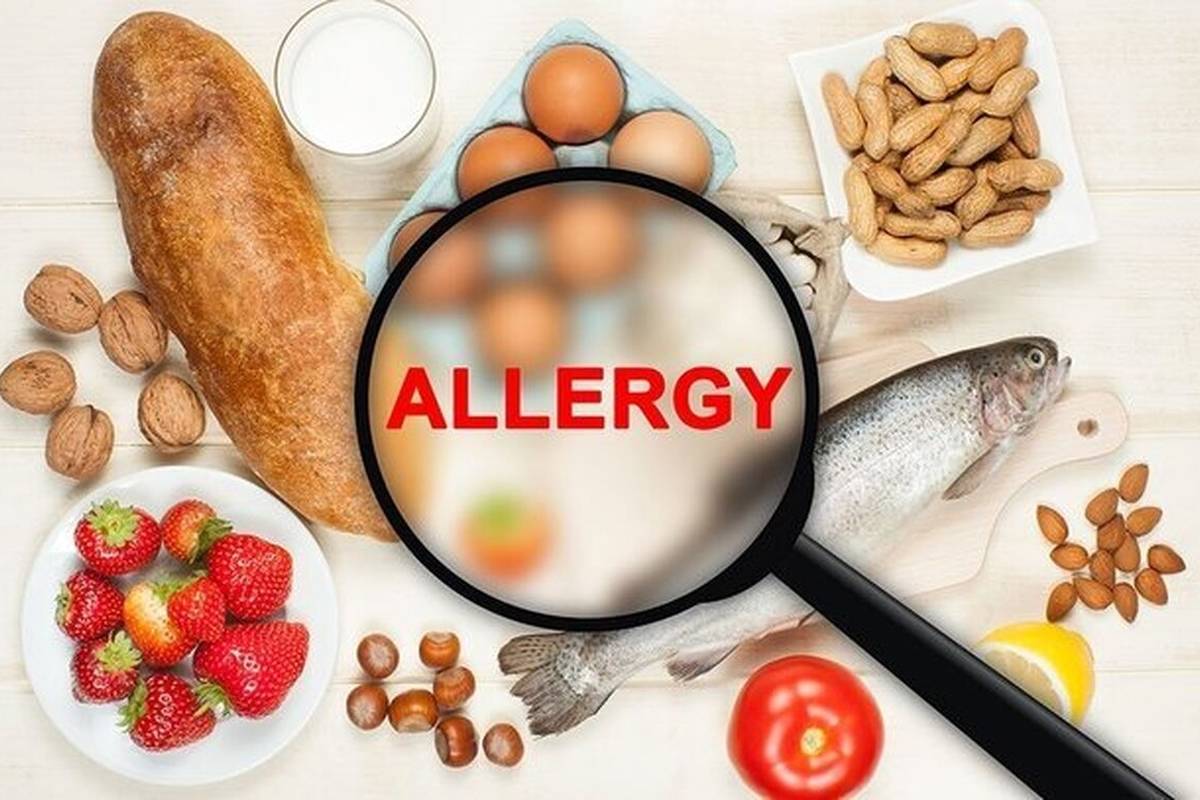 کدام خوردنیها بیشتر از همه آلرژیزا هستند؟