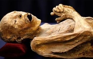 آیا جذام، سل و آبله از مومیایی‌های مصری قابل انتقال است؟