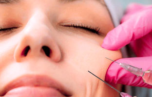 ۷ عارضه هولناک ژل و فیلرهای تقلبی/ سازمان غذا و دارو هشدار داد