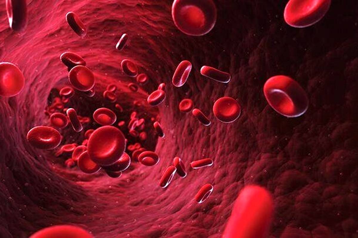 علائم شایع کم خونی فقر آهن چیست؟ + راه درمان