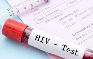 روش جدید پیشگیری از HIV؛ کاهش خطر ابتلا تا ۹۶ درصد