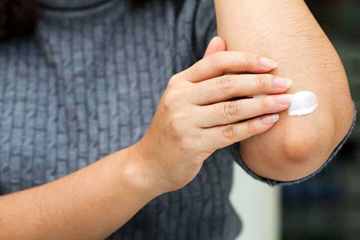 چرا پوست آرنج مستعد تیرگی است؟/ ۴ روش خانگی برای رفع تیرگی آرنج