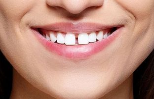 خوردن تخمه بین دندان‌ها فاصله می‌اندازد؟