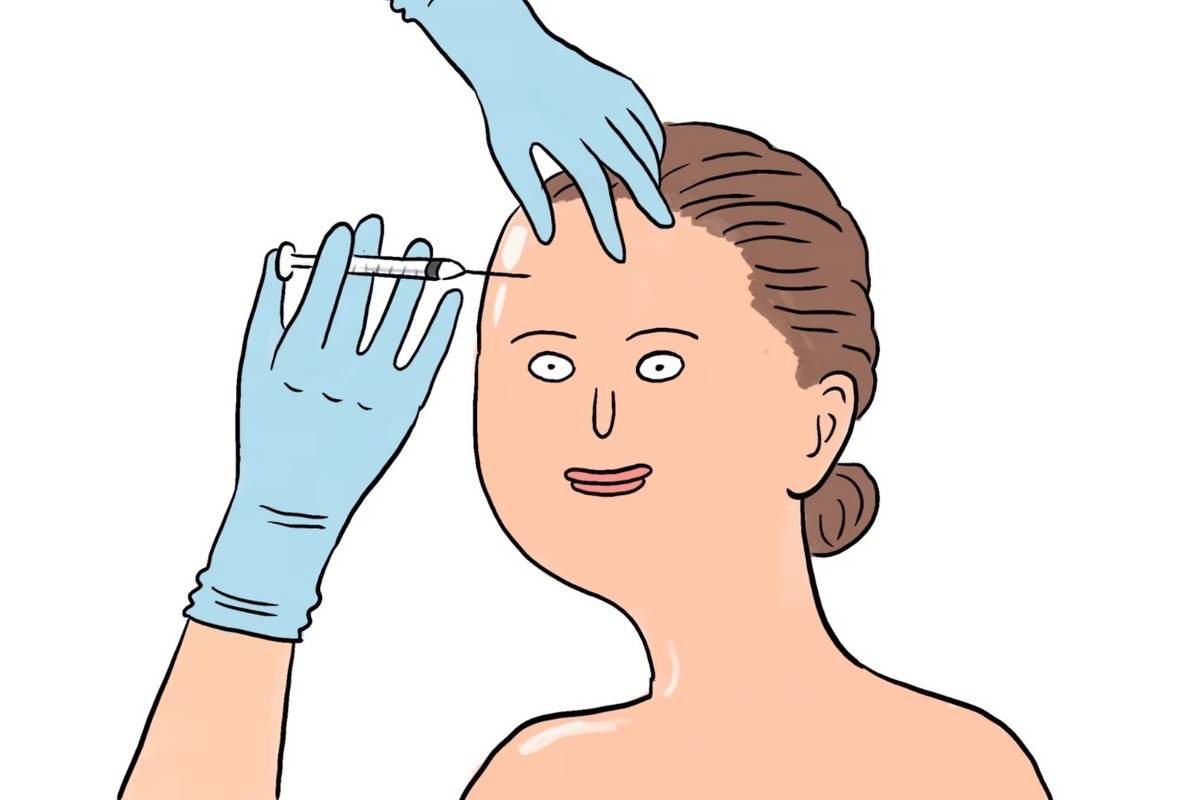 اگر از 20 سالگی بوتاکس بزنیم هیچوقت چینوچروک روی صورتمان نیمفتد؟