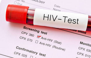 آمار ۶۵ درصدی ابتلا به اچ‌آی‌وی در ایران با تماس جنسی 