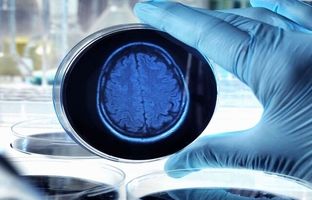 حذف ژن‌های تشدیدکننده آلزایمر با یک بمب نانویی