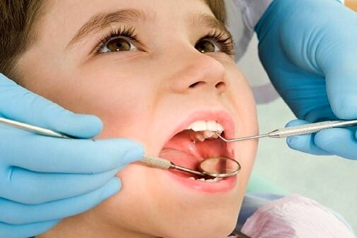 شیوع پوسیدگی دندان از کجا نشات میگیرد؟