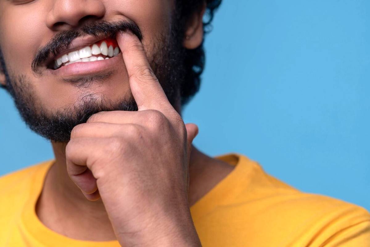 ۷ روش خانگی برای پاک کردن لکه های قهوه ای روی دندان
