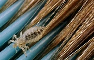 برای درمان سریع شپش در خانه چه کنیم؟