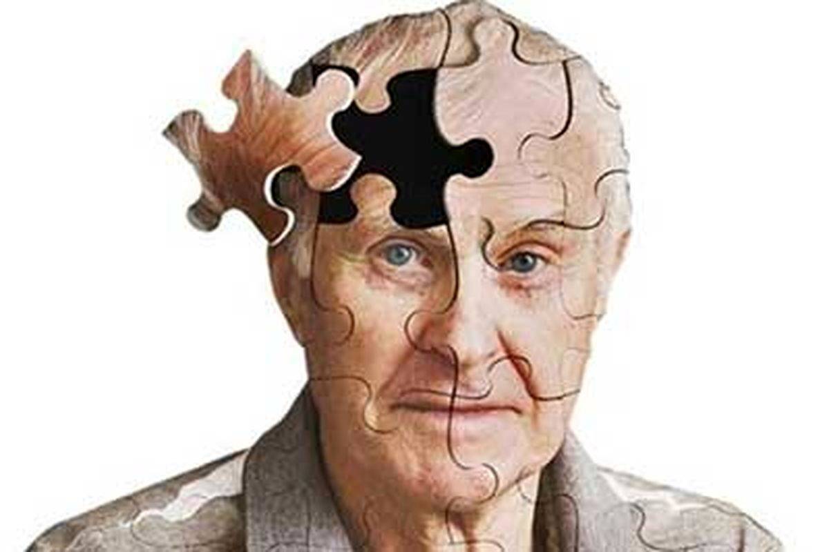 راه‌حل دانشمندان بلژیکی برای پیش‌بینی آلزایمر خانوادگی
