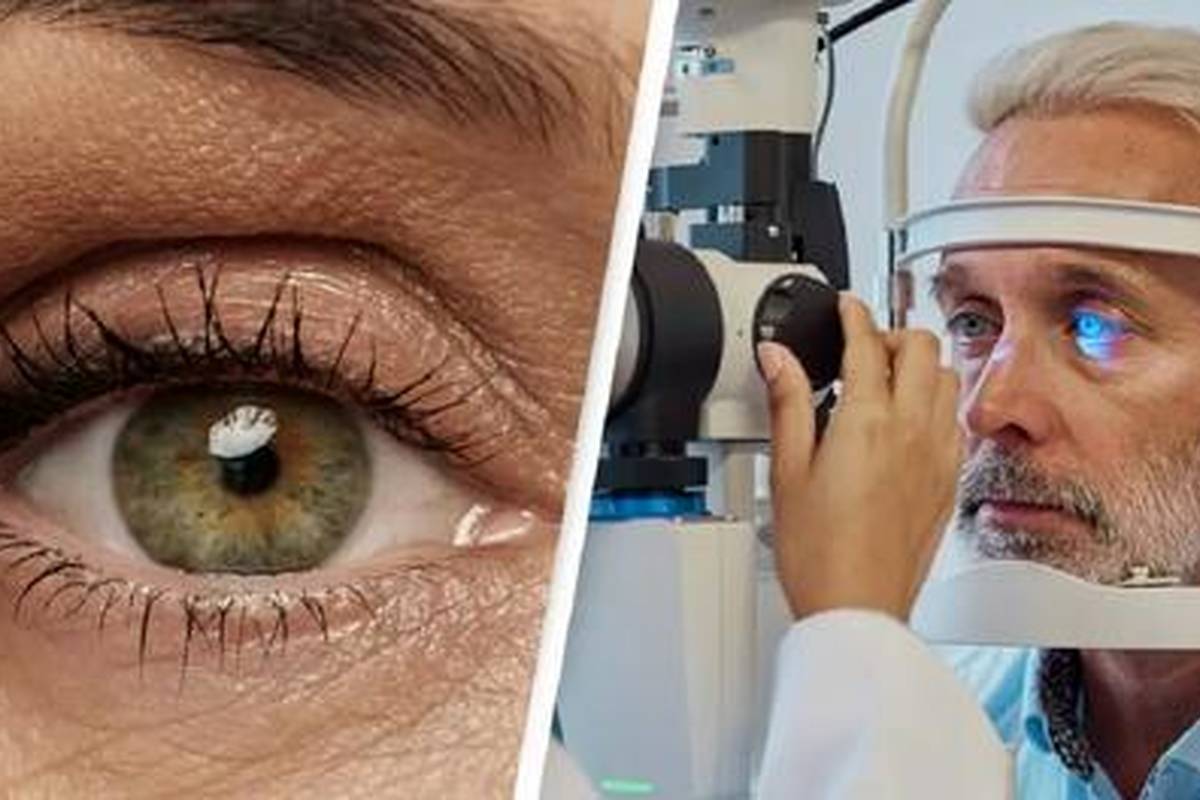 عکس کمیابترین رنگ چشم در جهان/ فقط یک درصد مردم چنین چشمهایی دارند