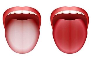زبان سفید چه چیزی درباره سلامت می‌گوید؟