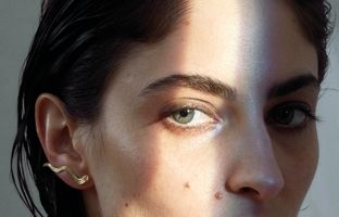 راهنمای متخصصان پوست برای درمان تیرگی دور چشم 